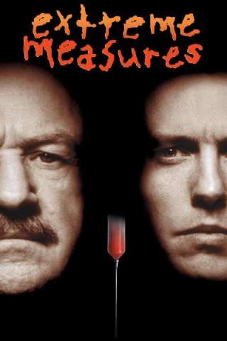 Extreme Measures - Soluzioni estreme [HD] (1996)